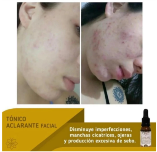 TONICO ACLARANTE FACIAL 25 ML - CLASS GOLD - Imagen 6