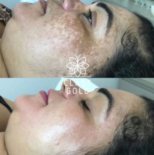 TONICO ACLARANTE FACIAL 25 ML - CLASS GOLD - Imagen 3