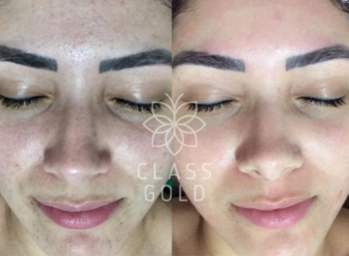 TONICO ACLARANTE FACIAL 25 ML - CLASS GOLD - Imagen 2