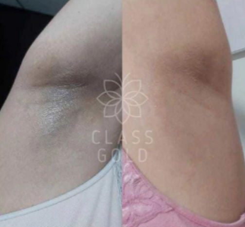CREMA DERMOACLARANTE 60 ML - CLASS GOLD - Imagen 4