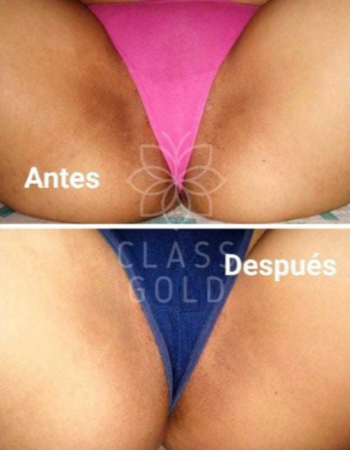 CREMA DERMOACLARANTE 60 ML - CLASS GOLD - Imagen 6