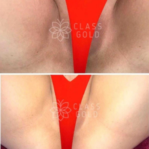 CREMA DERMOACLARANTE 60 ML - CLASS GOLD - Imagen 5